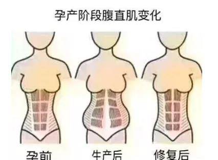 怎样缓解姨妈腰酸 ce4bd8e048584e2e855bd69ab639f71e.jpeg