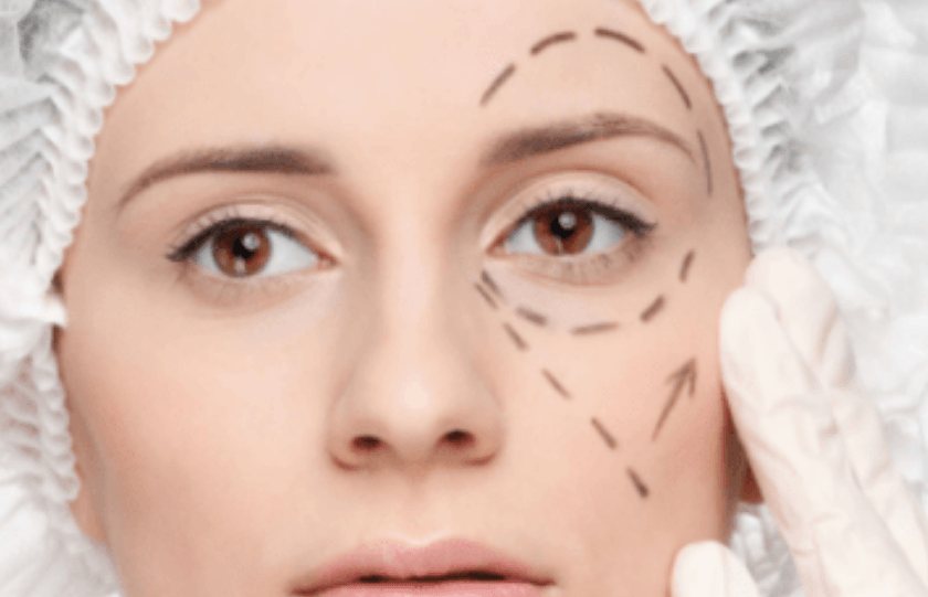 分析分析：热玛吉后多久可以打水光、做完热玛吉多久可以化妆~