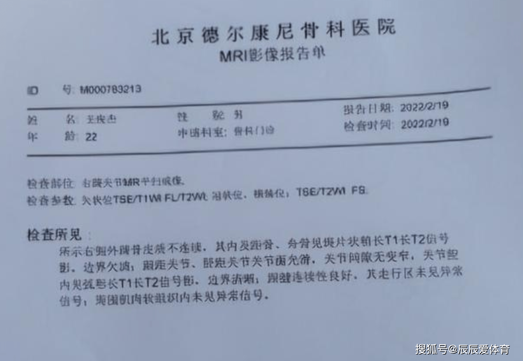 据王俊杰自己透露的就医报告显示,他遭遇了脚踝撕脱性骨折的伤病,这个