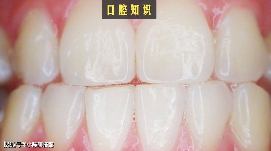 牙龈你以为每天早晚刷牙就够了？日常护牙还需知道这3点