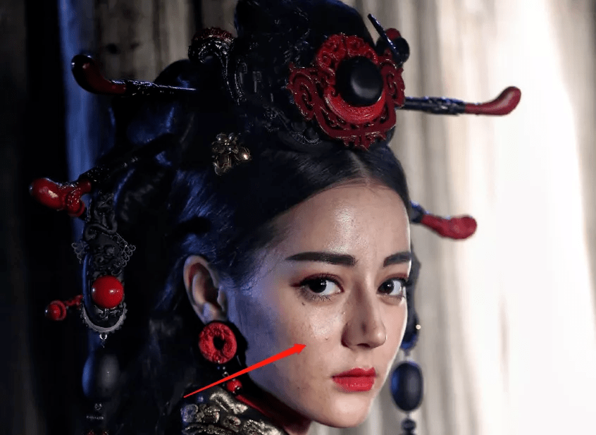 高清生浮粉、长痘、整容痕迹，明星未修图里的脸，让我看见了人间真实