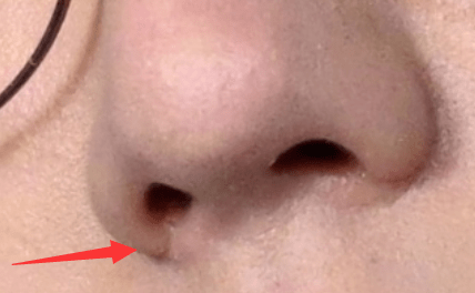 高清生浮粉、长痘、整容痕迹，明星未修图里的脸，让我看见了人间真实