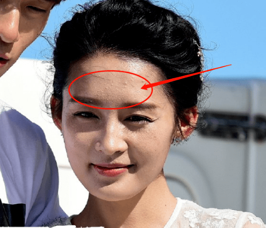 高清生浮粉、长痘、整容痕迹，明星未修图里的脸，让我看见了人间真实