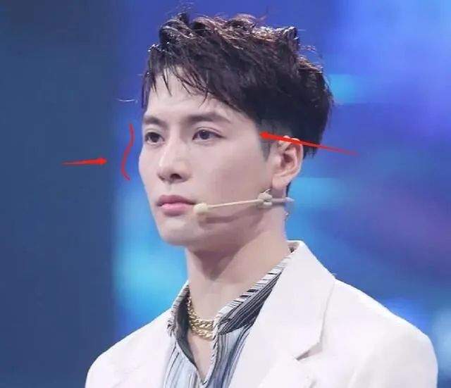 脸部明星整牙后遗症：杨幂脸部松弛，王嘉尔颧骨外扩，宋祖儿法令纹深