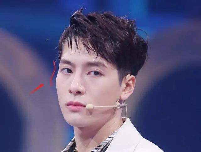 脸部明星整牙后遗症：杨幂脸部松弛，王嘉尔颧骨外扩，宋祖儿法令纹深