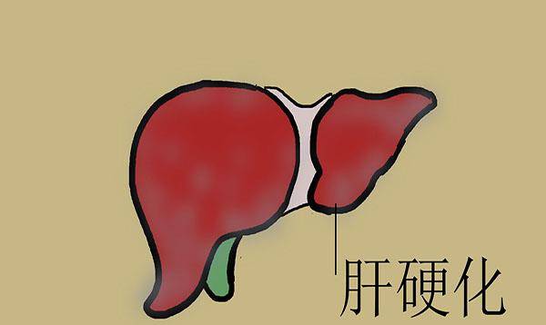 危害性|终于找到肝硬化的原因！是哪些习惯，将肝脏推到了硬化边缘？