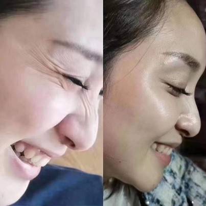 医学botulax细胞再生医学·细胞美容黑科技