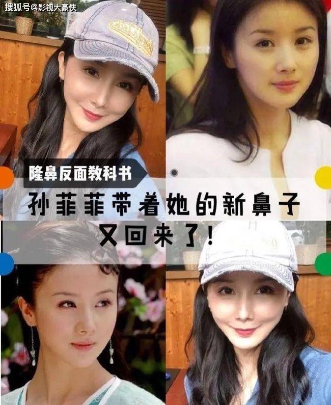 脸部被美容院毁掉的明星，娄艺潇秒变僵尸脸，张檬因整容葬送大好前途