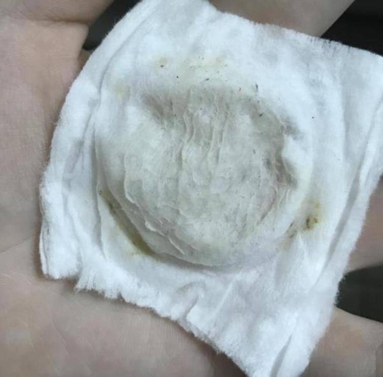 毛孔张嘉倪对自己“真狠”，把黑油皮变成“奶白肌”32岁看着像18少女