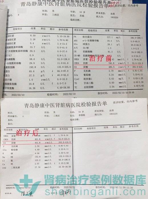 治疗|30年多囊肾被确诊尿毒症 “循经护肾疗法”中西医结合现转机