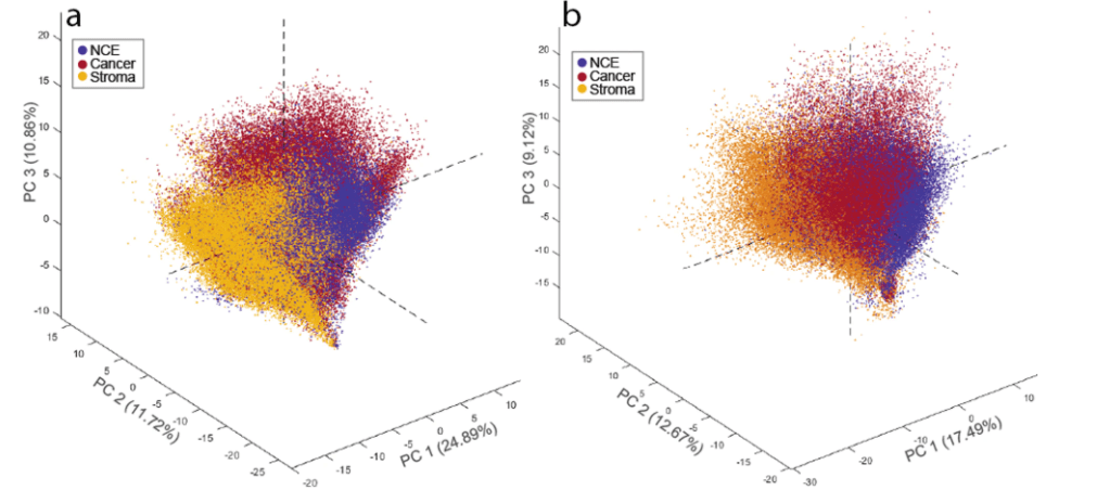 空间代谢组学技术研究前列腺癌的空间代谢差异