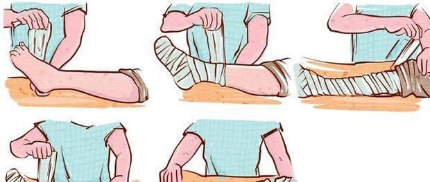 伤筋动骨100天,骨折病人的家庭护理,欲速则不达_石膏_活动_皮肤