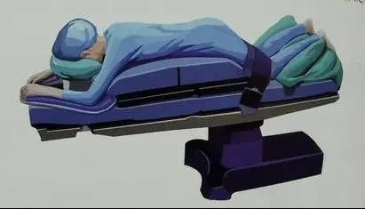 聊聊手术室里你不知道的"那些事儿"——手术患者健康宣教_麻醉_体位