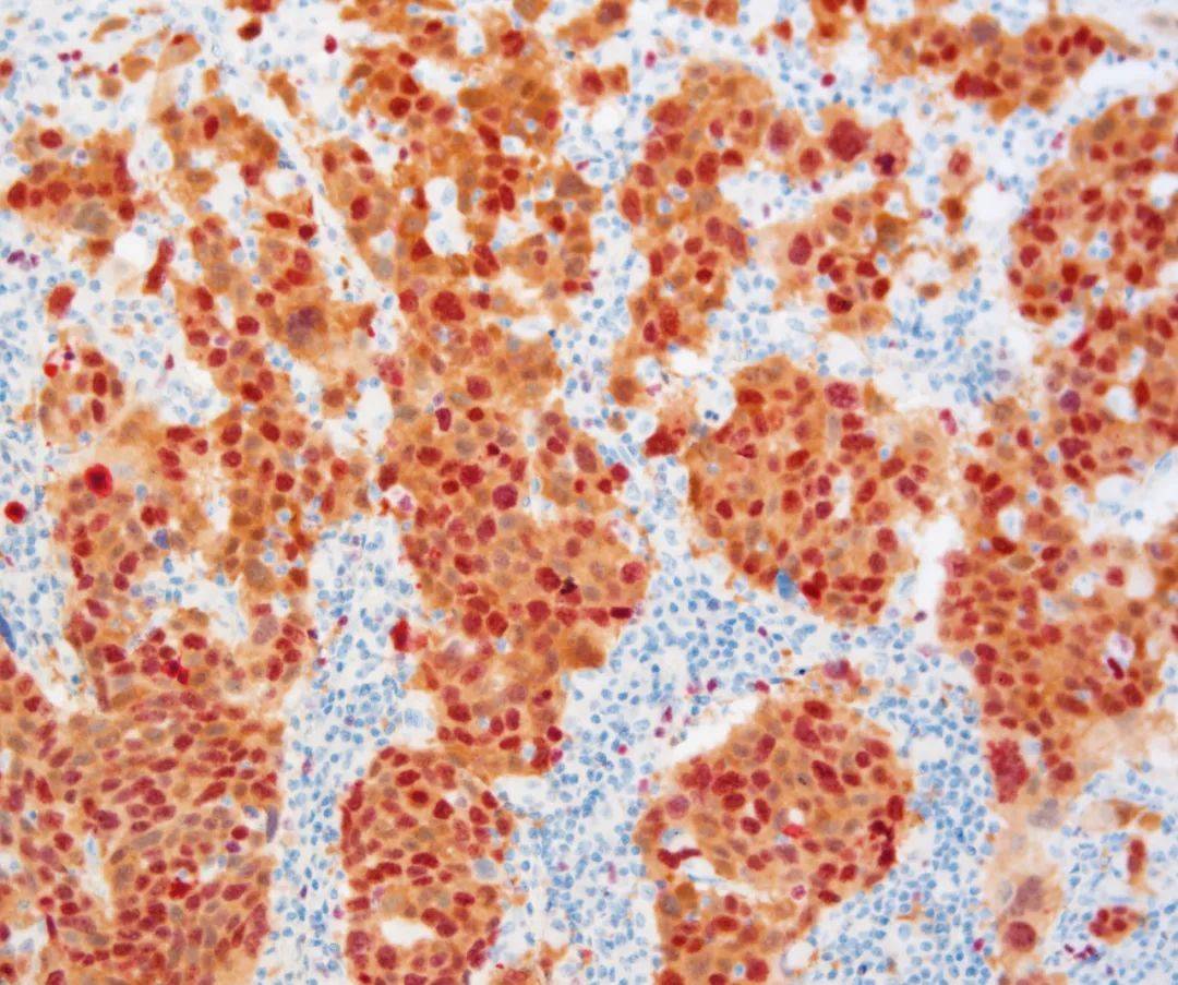 染色_过氧化物_颜色