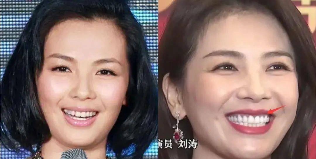 小天关晓彤是不是do脸了？凹脸变得幼态又平整