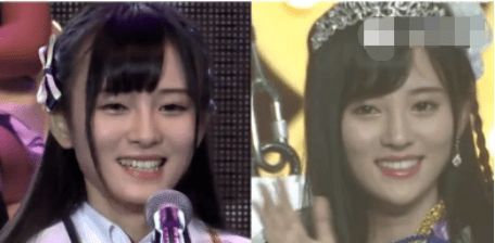 下巴5位“换头”成功付出代价的明星，鞠婧祎满脸硬伤，杨幂总是脸垮