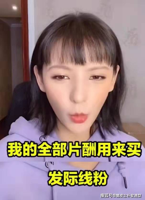 观点评论明星为了发际线有多拼？植发假发外加发际线粉，却败给胎毛王白鹿