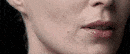 玛吉20岁发腮了怎么办?