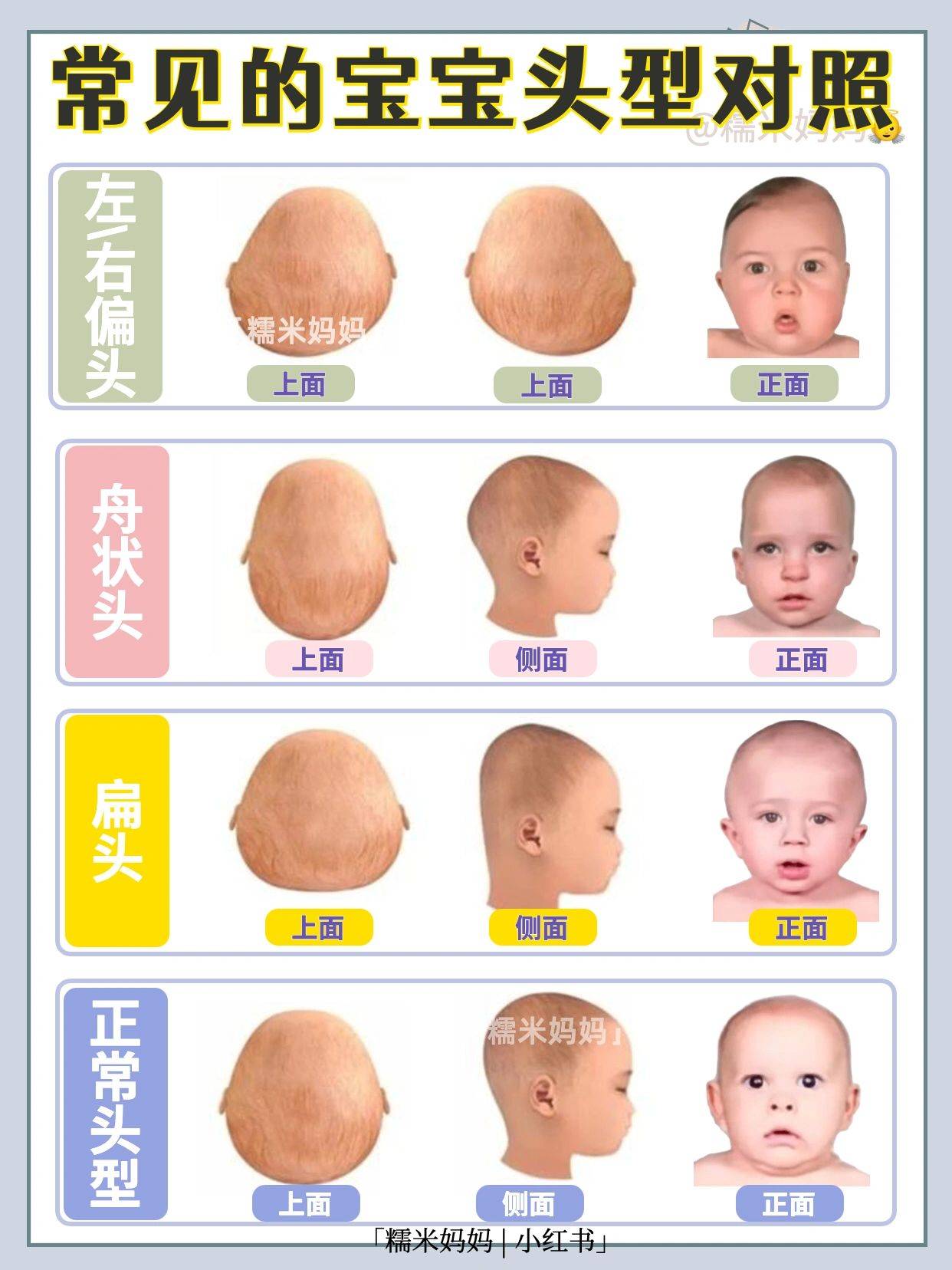 婴儿标准头型图片正面图片