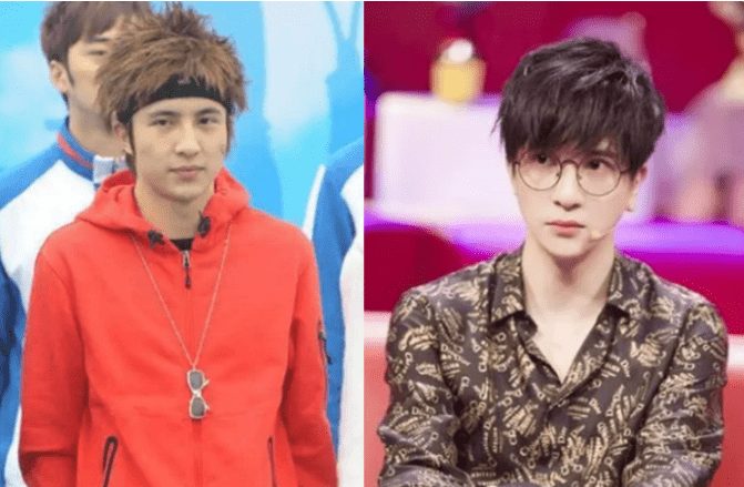 陈晓东脸部肿胀、五官扭曲,这些痴迷医美的男明星,不怕后遗症吗??