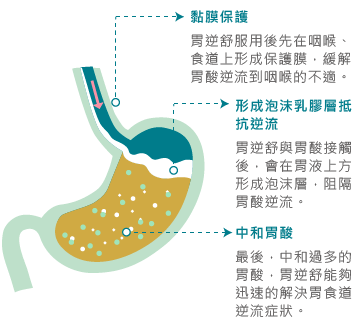 治疗胃酸 来自搜狐网