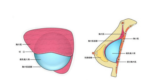 进行完美体态不可缺少的美胸，这样塑造