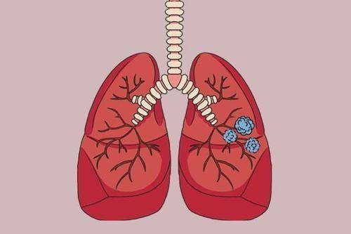 肺不好，身体往往伴有“1慢2突3多”，对照自查，看看你占了几个