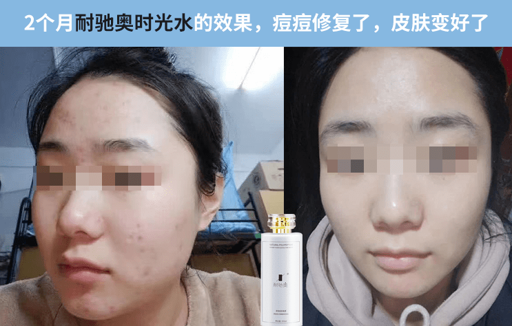 护肤品有皱纹了还能恢复吗，怎么去除细纹最有效，去细纹的小窍门（精）