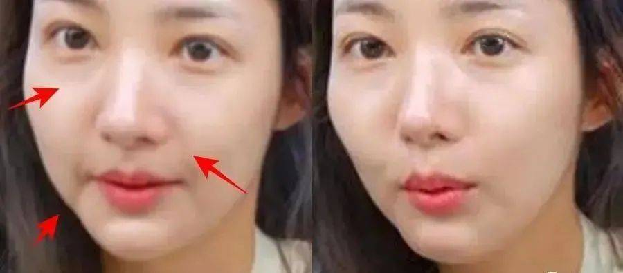 朴敏英8位中韩女神的“颜值克星”!法令纹在脸上“修渠”,个个显老