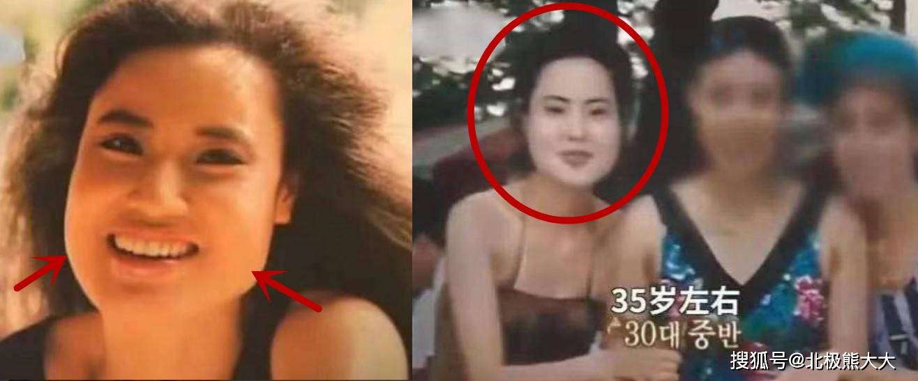 因为痴迷整容15年，把脸整成“电风扇”后遗症明显，韩慧景后悔了吗？