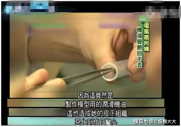 因为痴迷整容15年，把脸整成“电风扇”后遗症明显，韩慧景后悔了吗？