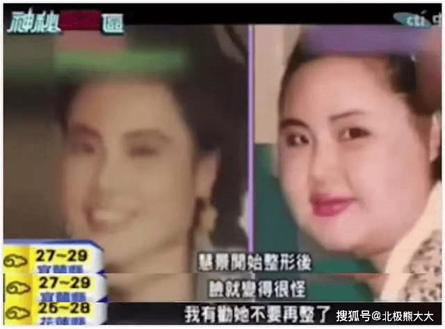 因为痴迷整容15年，把脸整成“电风扇”后遗症明显，韩慧景后悔了吗？