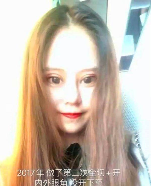 漂亮那个13岁就整容的网红女孩，3年整了60次，如今现状如何？