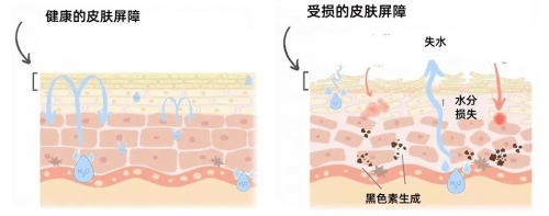 空气怎样改善春季皮肤敏感?长沙星城丽格教你从这几方面入手