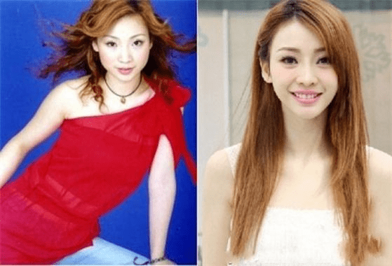 下巴整前似大妈、整完变少女？这些“回炉重造”的女明星，太成功了！