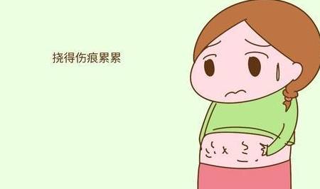 几类|孕期：妊娠纹偏爱这几类孕妈妈，你在其中吗？有法子避免吗？