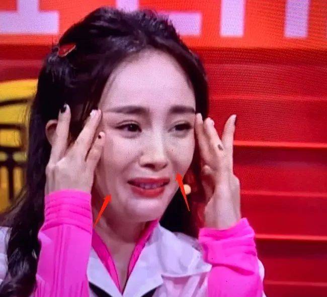 下巴整前似大妈、整完变少女？这些“回炉重造”的女明星，太成功了！