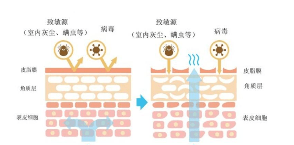 方法这几种肤质的女生，千万别用“油敷”护肤了，越用油皮肤越干！