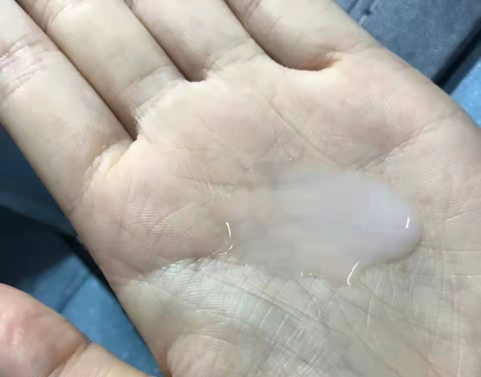 产品美白产品不管用?想要高效美白,这些美白成分CP了解一下!