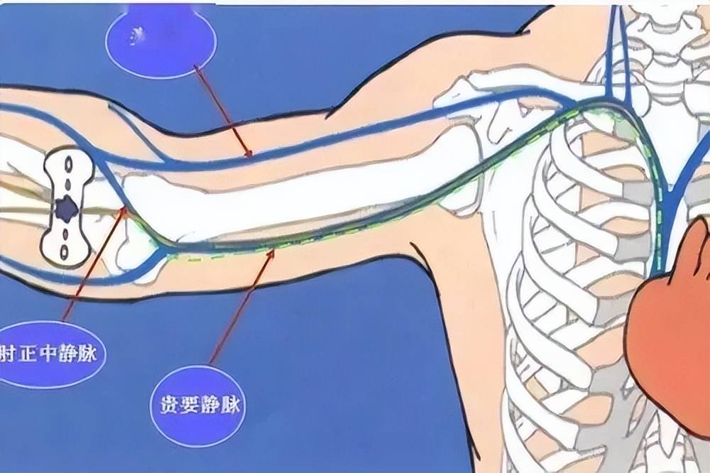 垂直静脉图片