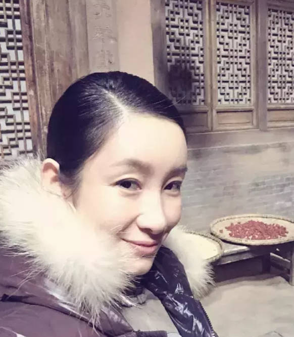 单眼皮女星割双眼皮如跨分水岭，没整好变“悲伤蛙”，成功则变气质美女？