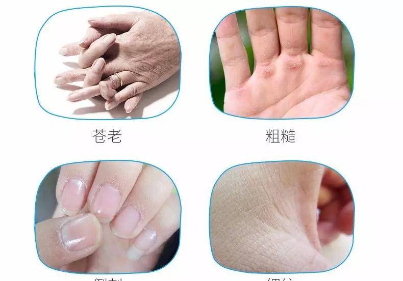 手部38岁谢娜参加活动，却被双手抢镜，网友：难怪张杰这么爱她