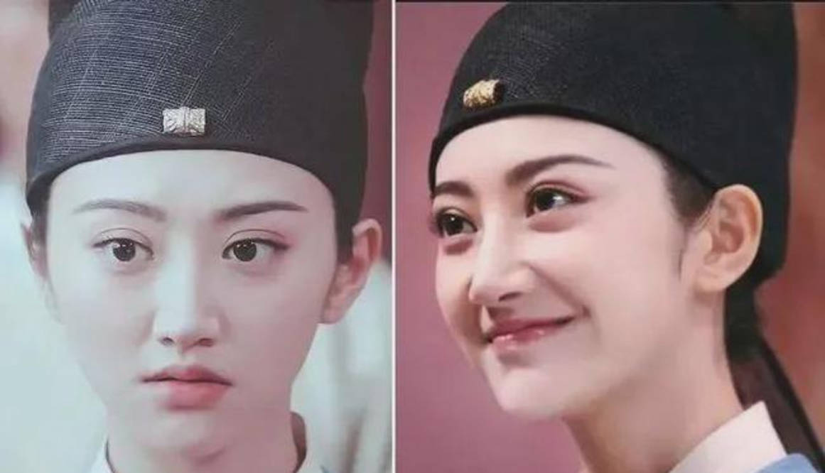 单眼皮女星割双眼皮如跨分水岭，没整好变“悲伤蛙”，成功则变气质美女？