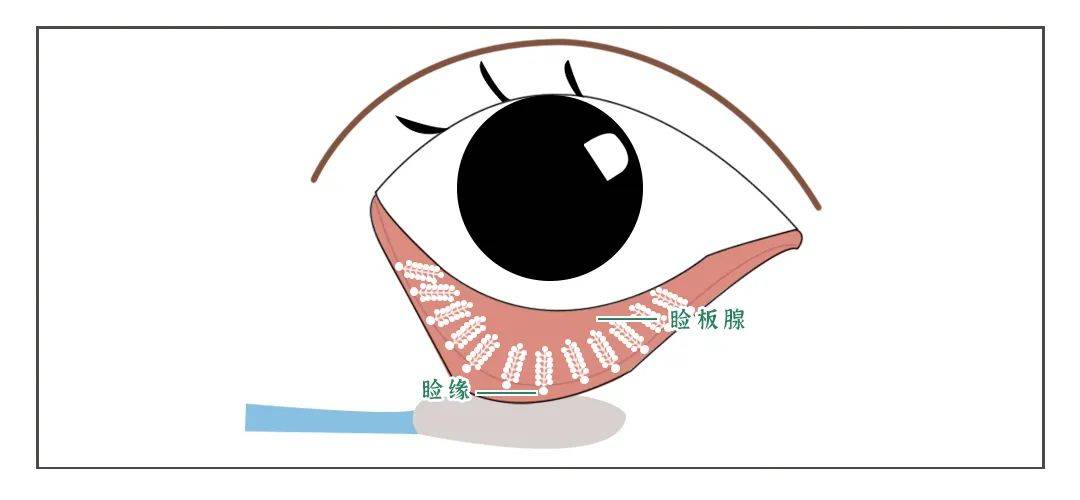 护眼科普自测睑板腺是否健康干眼症4步缓解