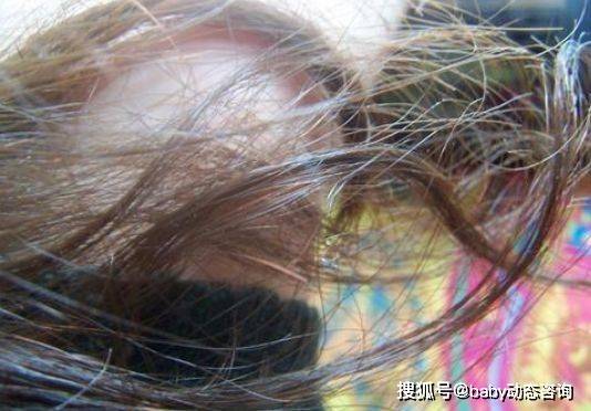 原创女生常吃黑芝麻对身体好营养师却说食用不当会引起肥胖