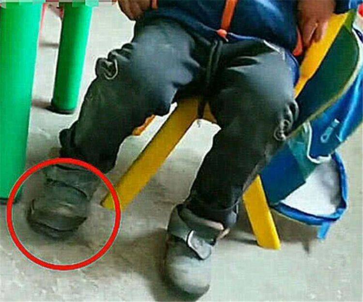 孩子在幼儿园上课一直"跺脚",老师走近一看,忍不住湿了眼眶_儿童_父母