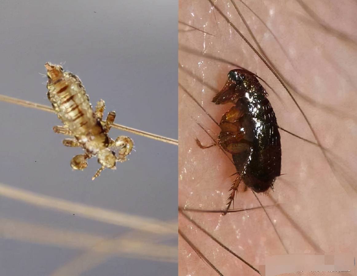 虱子”与我们共存千万年，为何这几年见不到了？_搜狐网, image size:1162x900