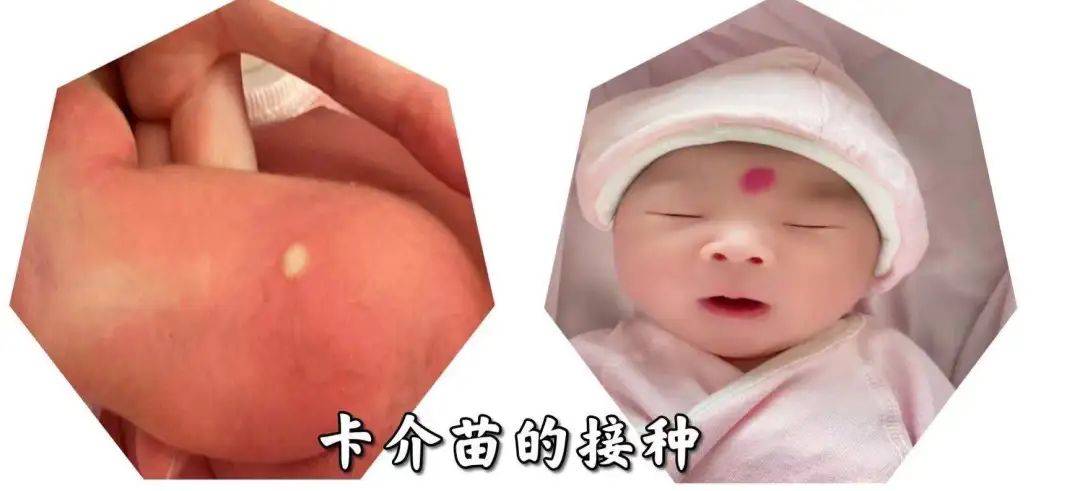 宝宝出生后为什么要接种乙肝疫苗和卡介苗?