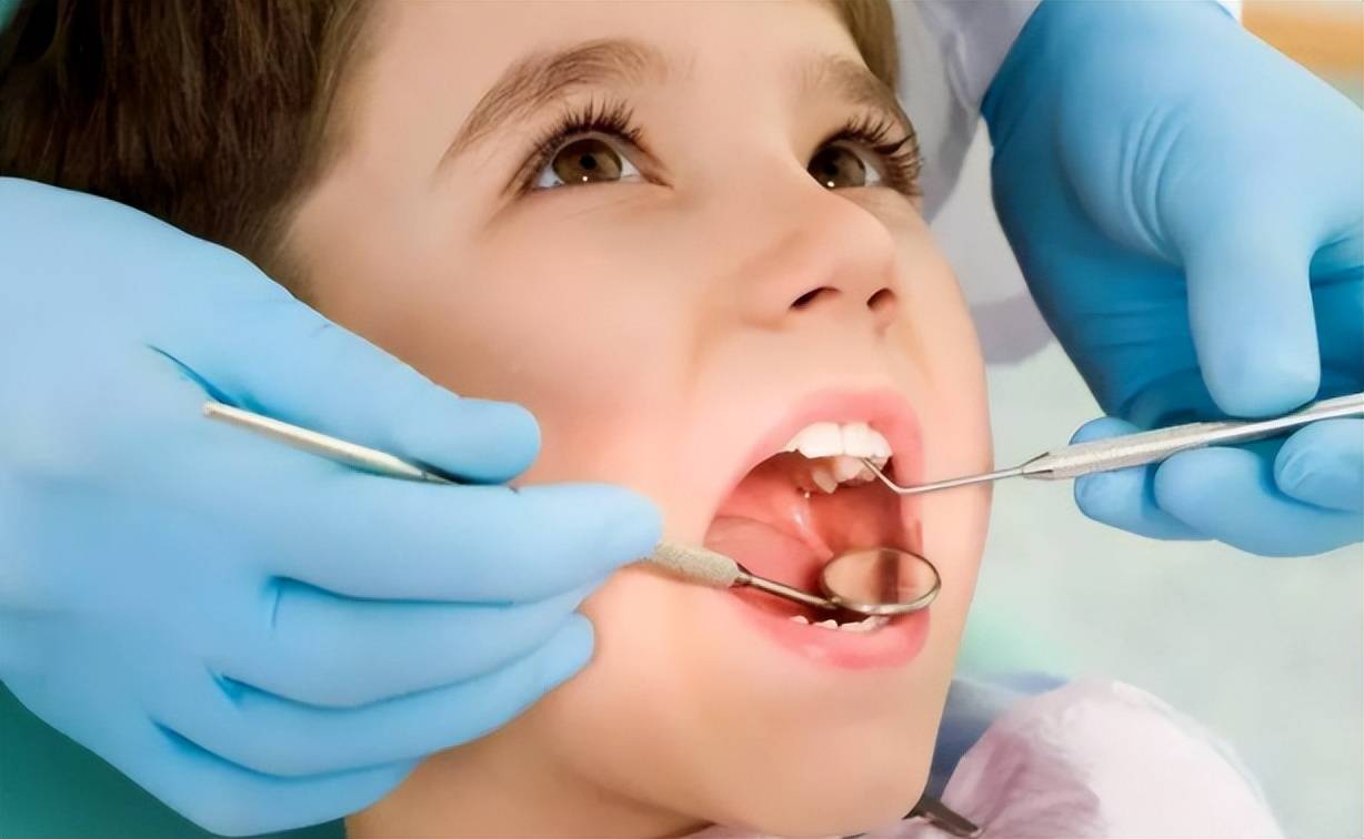 预防儿童龋齿 牙齿涂氟不可小看