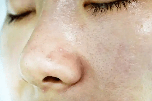 水媚蛙护肤课堂皮肤暗黄粗糙肤色不匀补水这步就没做对